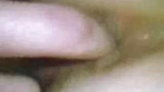 यो खोपडी को पर्यवेक्षण अन्तर्गत नीरस कमबख्त।