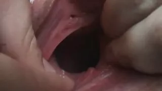 यो क्यान्सर उठ्छ र तपाईं च्यात्नु गर्न अनुमति दिन्छ.